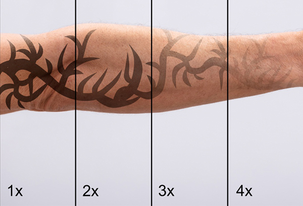 D&eacute;tatouage